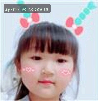 孙婷婷
